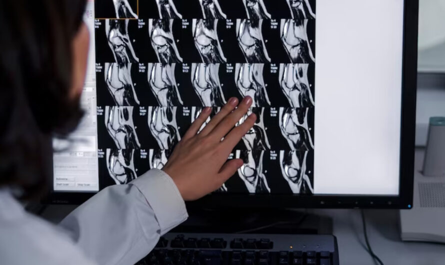 Entendendo a telerradiografia lateral: seu papel e impacto na medicina moderna
